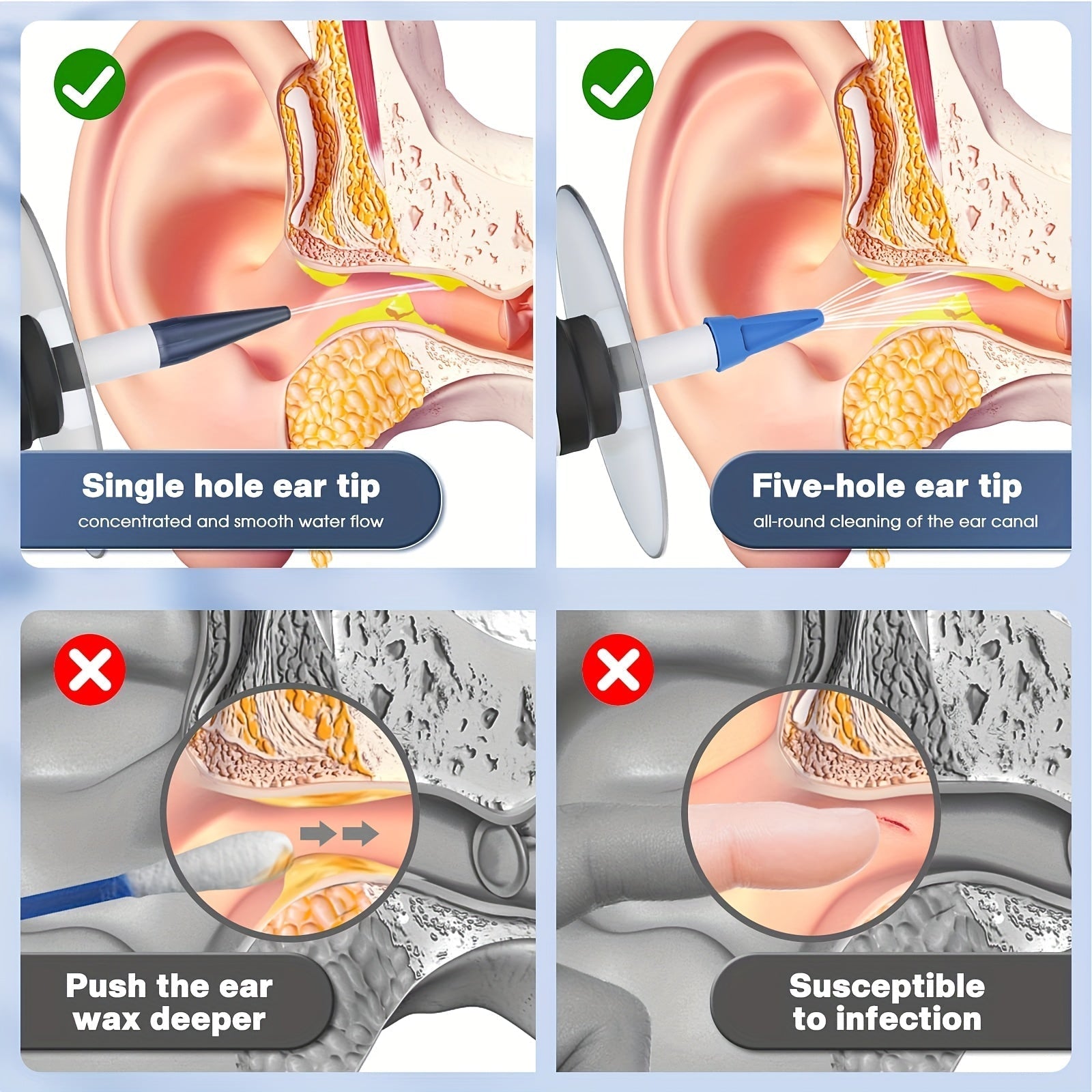 Electric Ear Cleaning Set – Safe Irrigation System with Disposable Nozzles