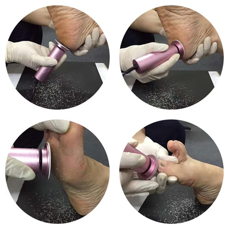 Confident and Comfortable with Silky Soft Feet - Say Goodbye to Calluses