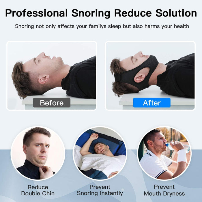 SnoreGuard - Comfortable Chin Strap for a Quiet and Peaceful Night's Sleep