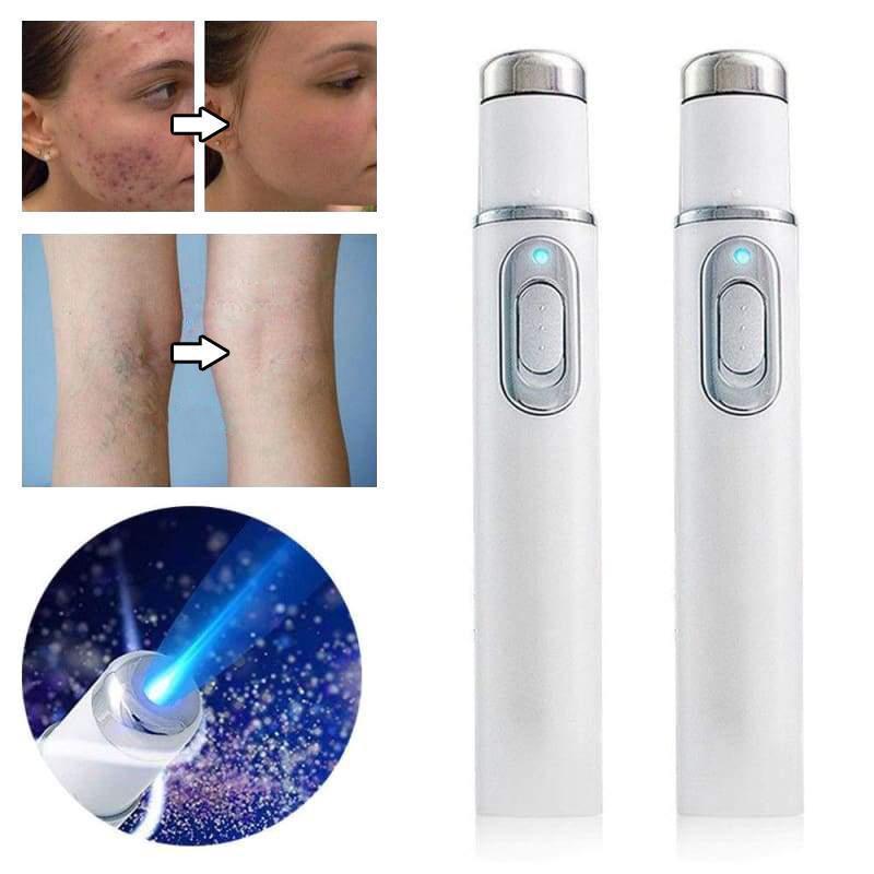 Laser Treatment Pen Blu-Ray for Removing Unwanted Acne
