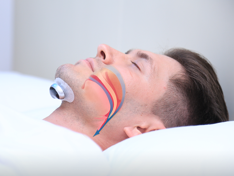Comfortable Anti-Snoring Device – QuietWave
