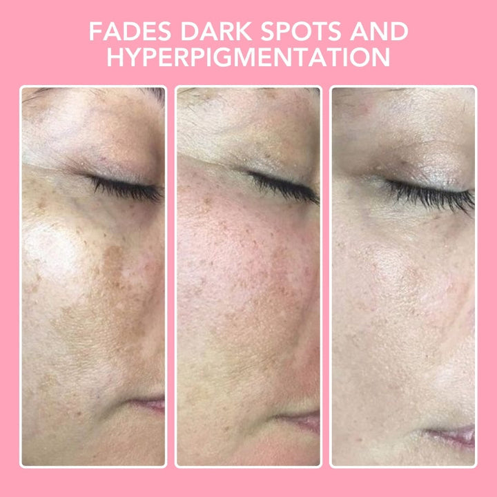 Turmeric Kojic Acid Cleansing Pads - GlowTonic