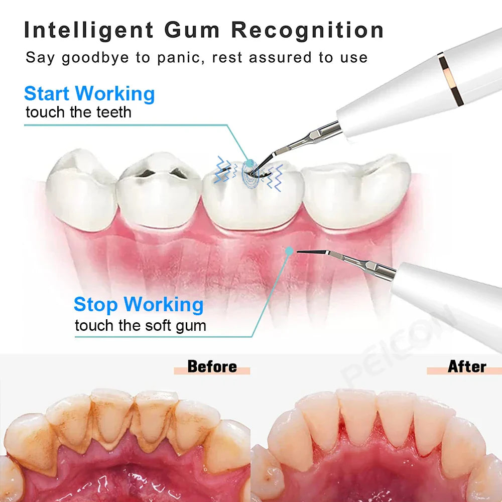 Ultrasonic Toothbrush - SonicClean