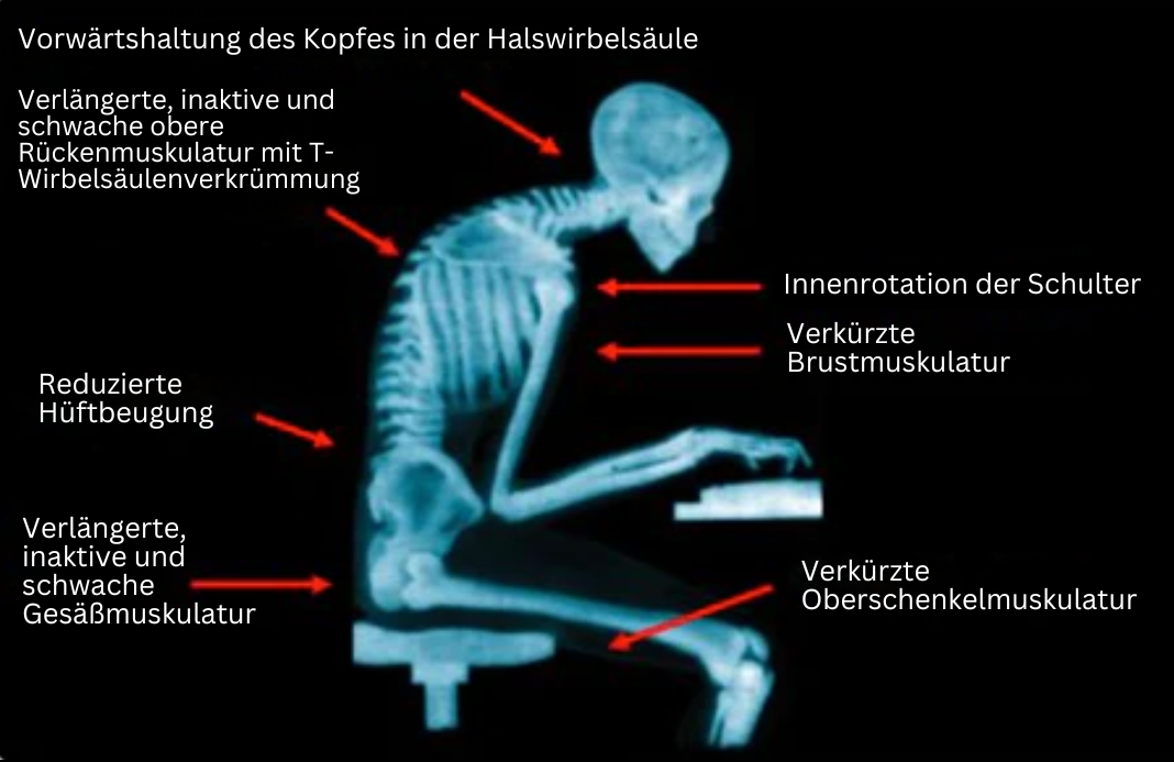 EMS Posture Band - PosturePro