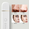 Deep Cleansing Skin Scrubber