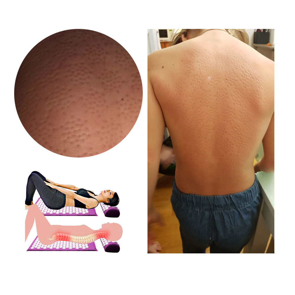 Acupressure Yoga Mat & Cushion Set – RelaxMat