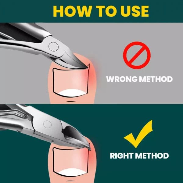 Orthopaedic Nail Clipper