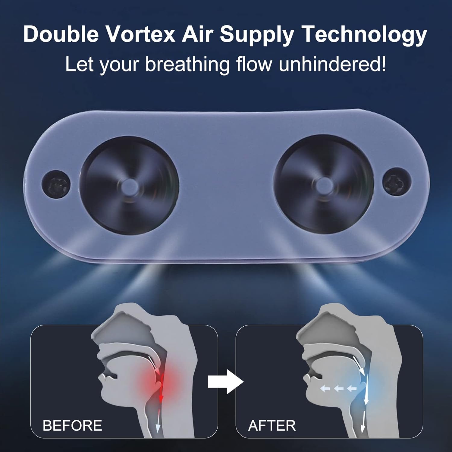 Micro CPAP Device - Anti-Snoring