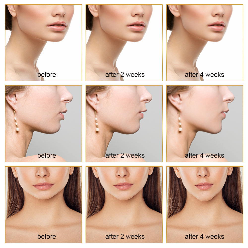 EMS Facial Slimmer with LED Therapy - Slimmer Face and Double Chin Removal
