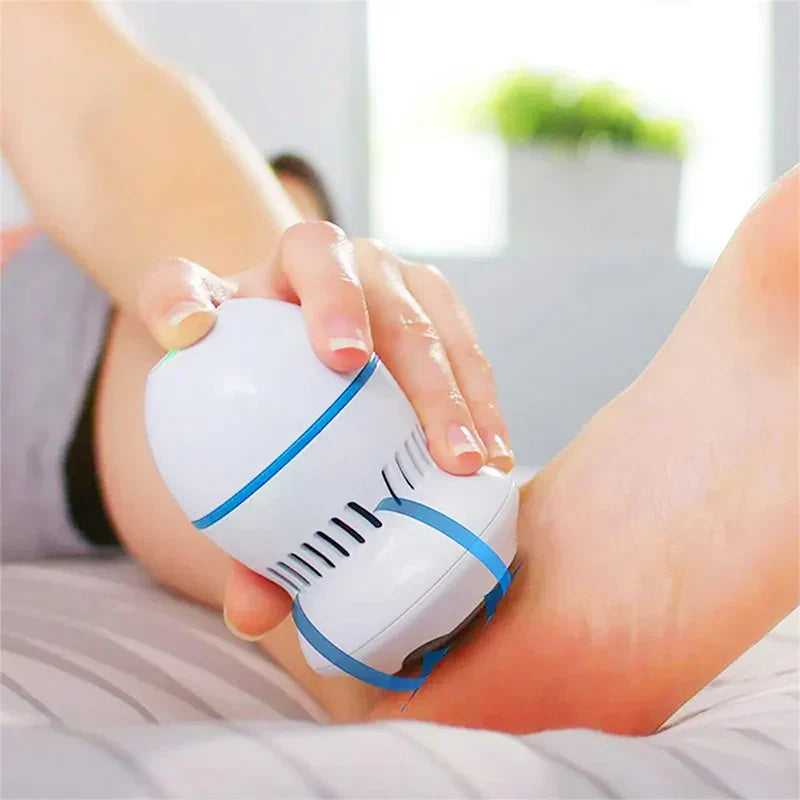 Professional Electric Callus Remover - SoleCare