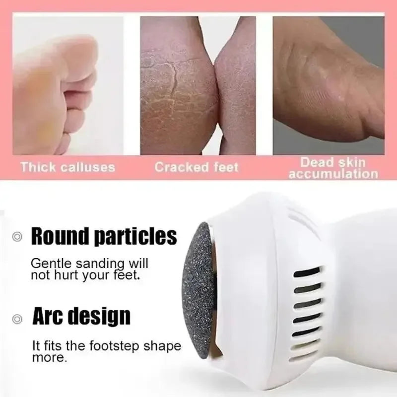 Professional Electric Callus Remover - SoleCare