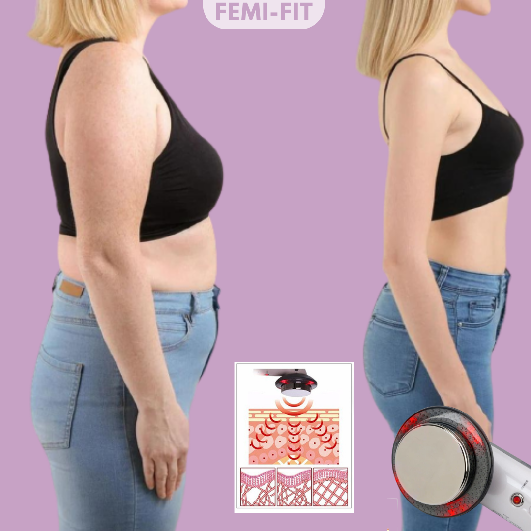 3-in-1 Fat and Cellulite Remover – SlimShape