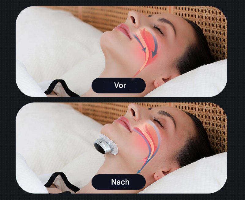 Sleep Apnoea Aid - AirEase