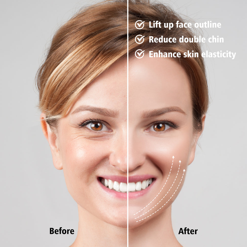EMS Facial Slimmer with LED Therapy - Slimmer Face and Double Chin Removal