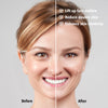 EMS Facial Slimmer with LED Therapy - Slimmer Face and Double Chin Removal