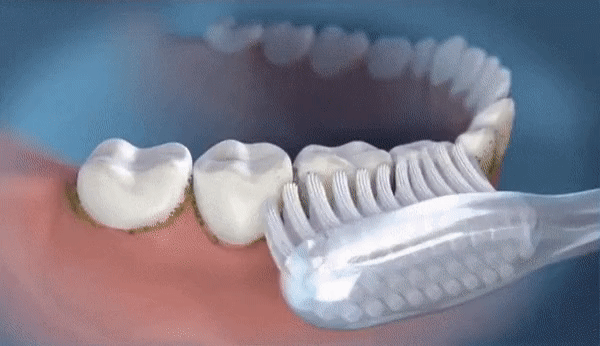 Water Flosser - Painless Flossing | Three Colour Options