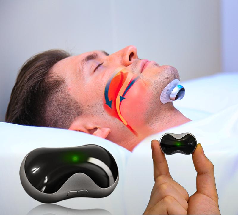 SnoozeFix Anti-Snore Device - Improve Your Sleep with Comfortable Technology